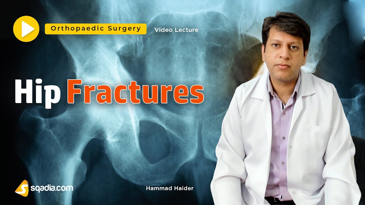 Hip Fractures | Orthopaedic Surgery Lectures | Clinical V-Learning