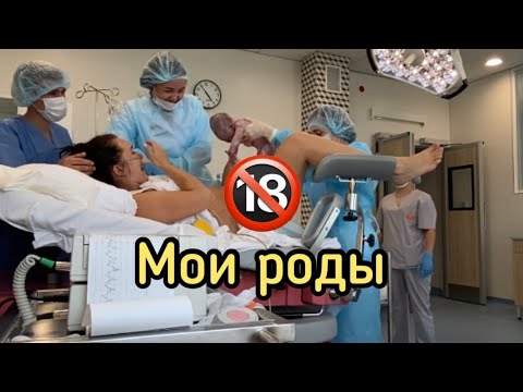 Роды. Схватки. Потуги.