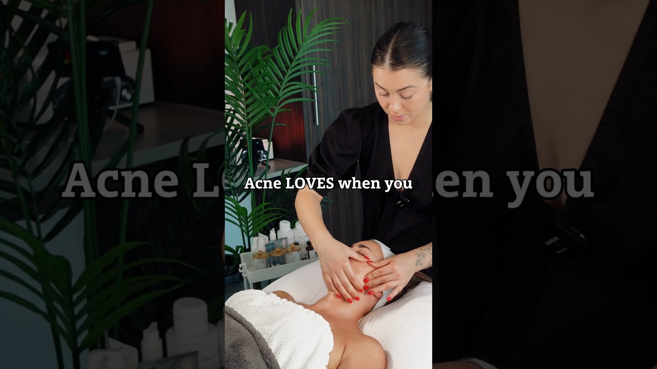 Acne LOVES when you: (check the description) 