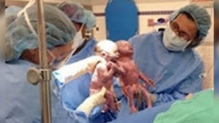 The Nurse Couldn&#39;t Help But Scream, The Mother Takes A Look At Her Twins And Realizes What Happened