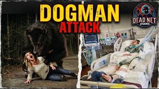 8 REAL Dogman Encounter: Woman Nearly Killed by Beast Profile