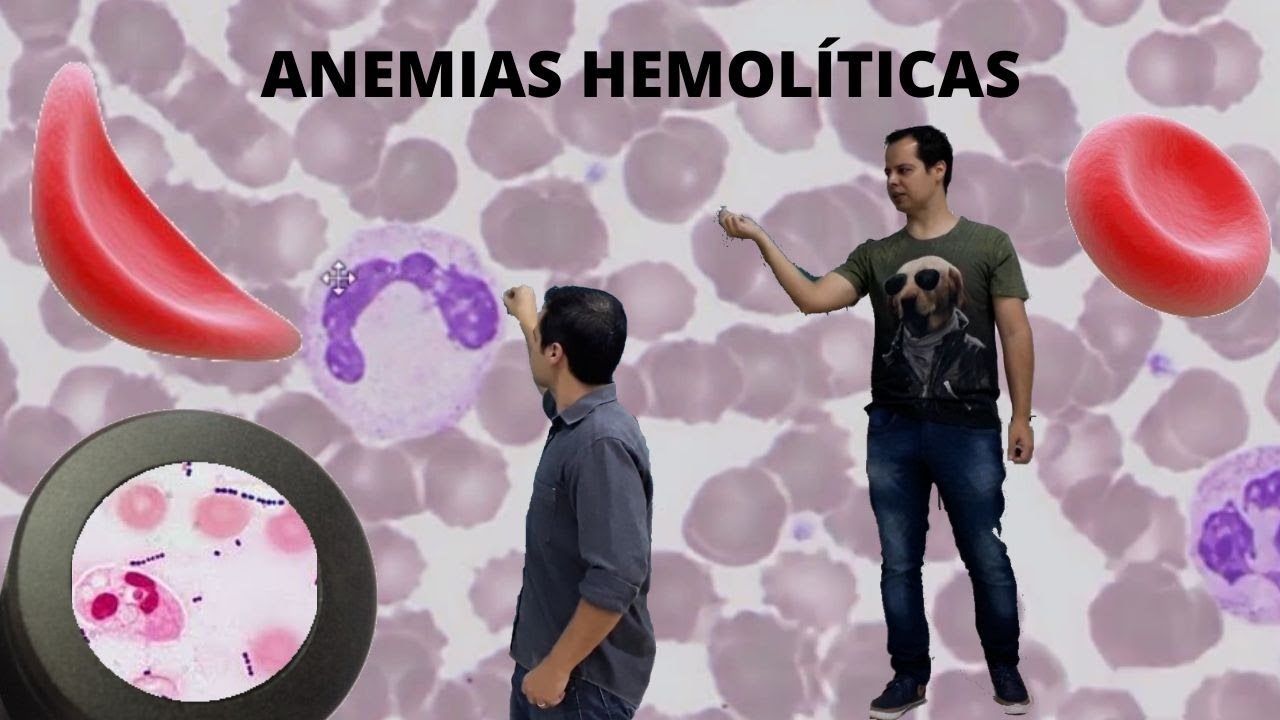 Anemias Hemolíticas - Aula Ao vivo com Professor Eden Rodrigues