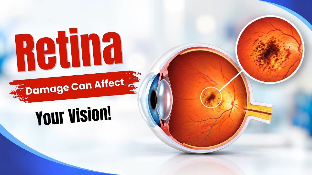 Retina Problems Can Affect Your Vision | Symptoms, Causes & Treatment Explained | Mitra Eye Hospital