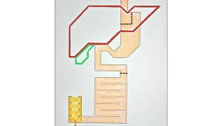Gastric Bypass Operatie