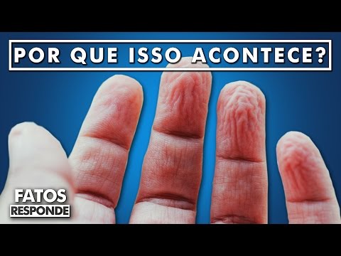 Vídeo: Quanto Tempo Molly Permanece No Seu Sistema?