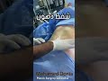 شفط دهون البطن الحل الامثل لجسم مثالي دكتور محمد دنيا دكتور تجميل جراح تجميل شفط دهون تنسيق قوام