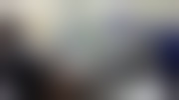 Hot AXIOS Step by Step  HD 2019. deployment for pseudocyst drainage, México.