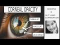Corneal opacity   grading  clinical examination  adherent leucoma nebular macular  leucomatous