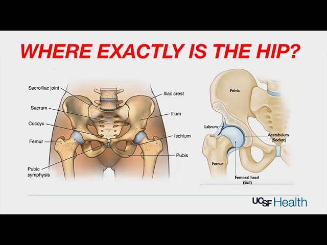 Hip Pain Location Diagram