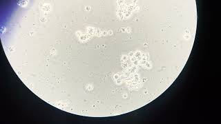 Bacterial contamination in cell culture