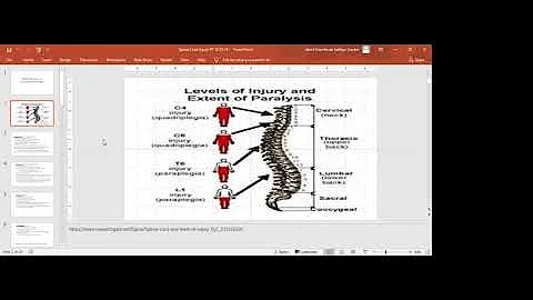 Spinal Cord Injuries Part 1 Webinar by OT ECHO Mentorship
