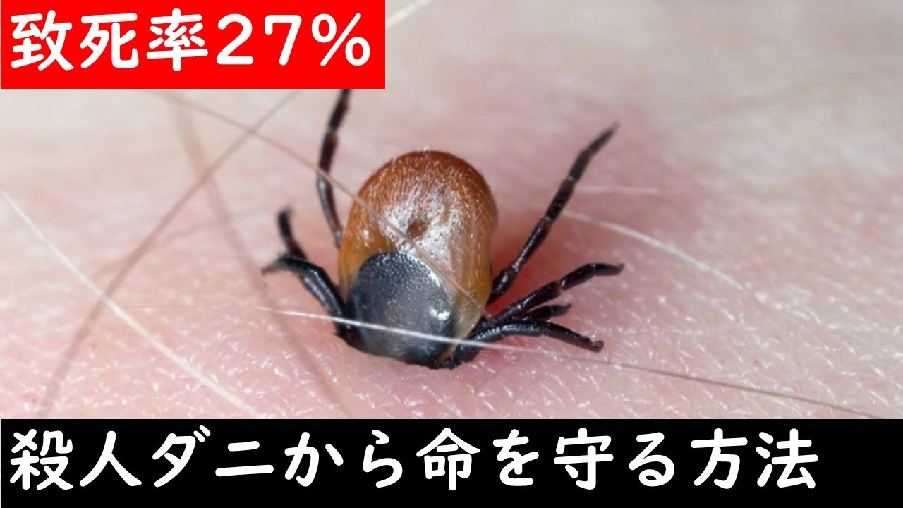 【恐怖の実体験】マダニに咬まれ死にかけて学んだ、命を守る対処・対策。 - YouTube