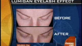 Drug Lengthens Eyelashes