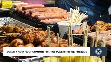 Obesity now most common form of malnutrition for kids