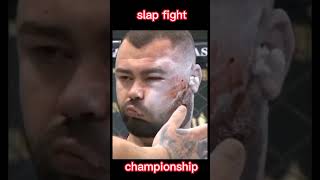 Swelling Face😢 SLAP FIGHT CHAMPIONSHIP screenshot 1