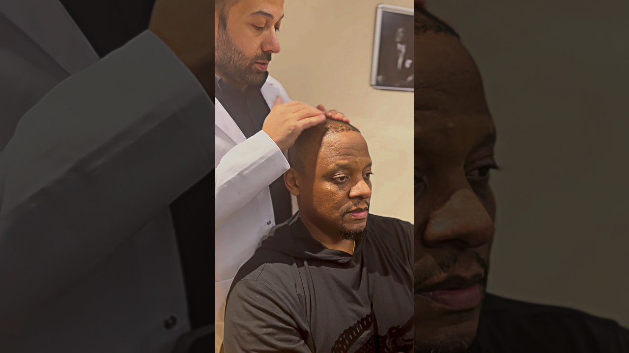 Afro Hair Transplantation