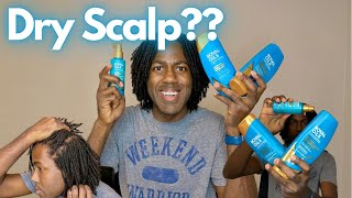 DRY SCALP WITH LOCS GET RID OF DANDRUFF DIY Braidlocs Royal Oils Line