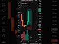 Sensex Expiry #scalping #tradingstrategy #youtubegrowth