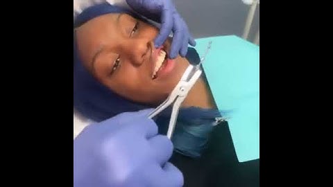 Dr Katz showing how seamless removal of braces can be  Sade was elated brac    1449234965218189