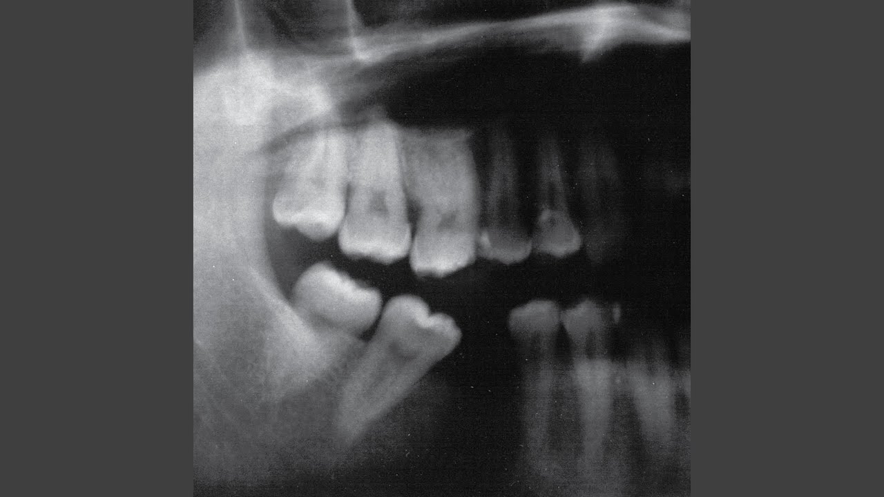 Take Nothing with You