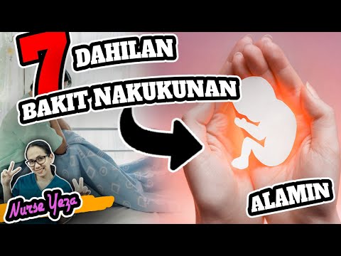 Video: Bakit Nangangarap Ng Pagkalaglag