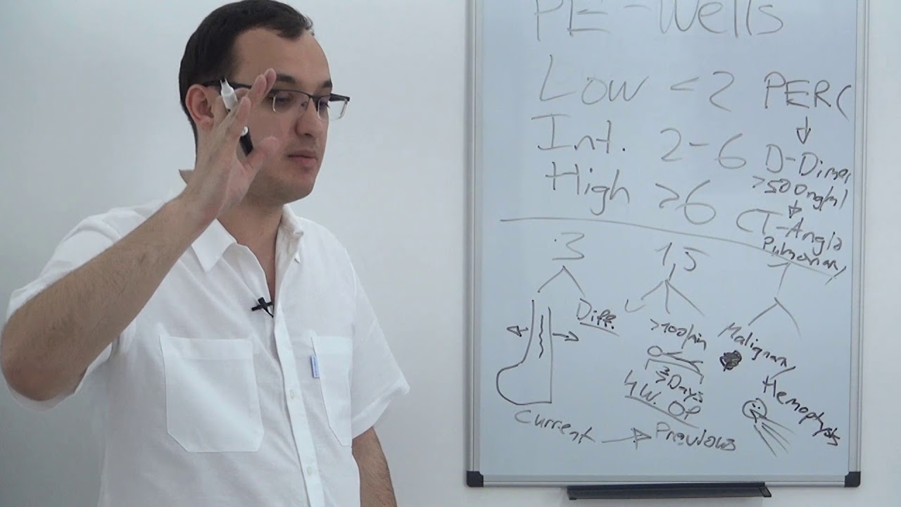 Pulmonary Embolism : Wells criteria