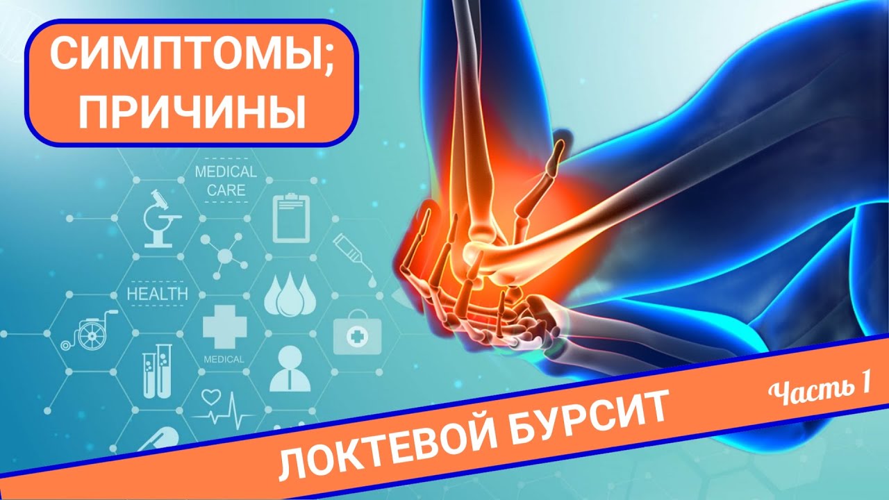 НЕ СГИБАЕТСЯ РУКА | Локтевой бурсит (Часть 1) - YouTube