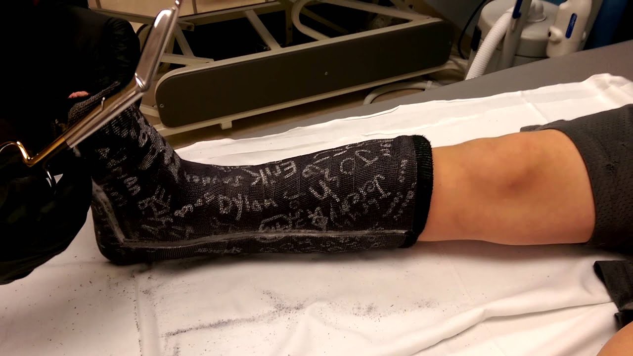 Cast removal YouTube