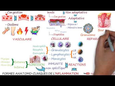 Vidéo: Sont les manifestations cliniques de l'inflammation ?