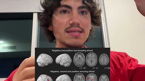 RADICAL OPTIMISM Will Change Your LIFE (Research Supported)