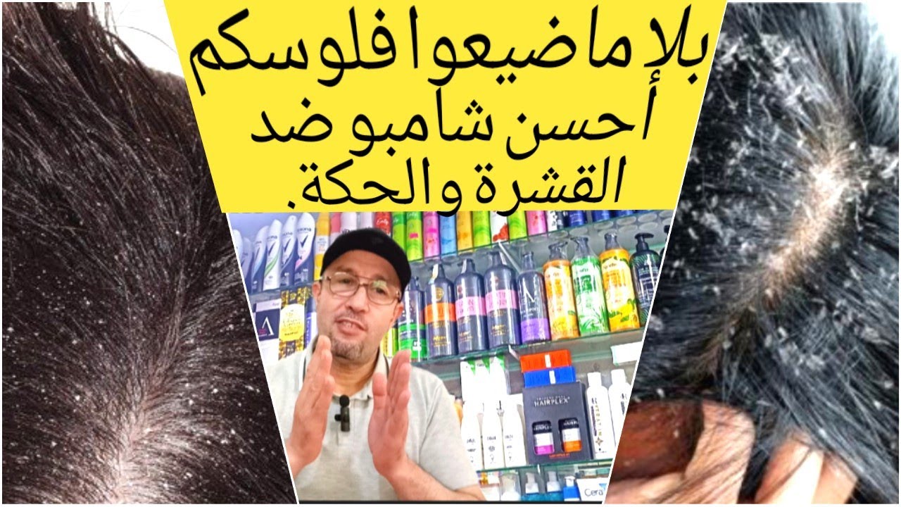 أحسن شامبو لإزالة القشرة والحكة سواء للشعر الجاف او الدهني champoo anti pelliculaire secs et grasses
