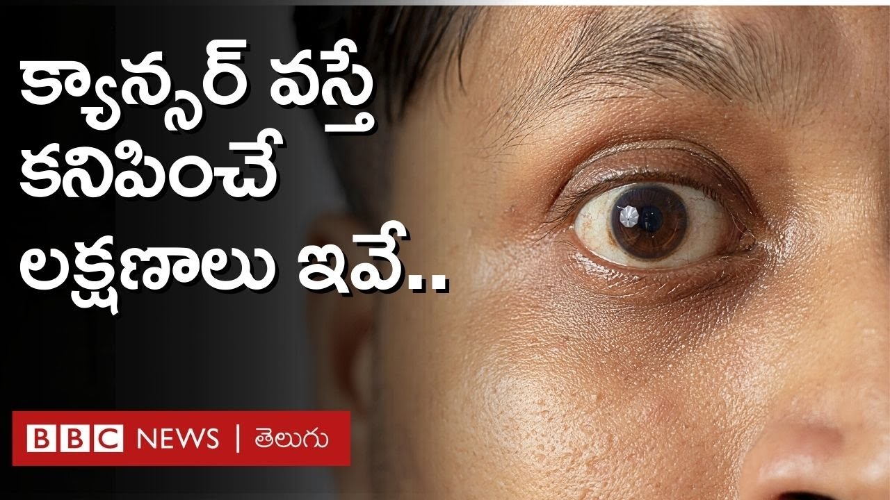 World Cancer Day: క్యాన్సర్ వస్తే కనిపించే 10 లక్షణాలు ఇవే.. | BBC Telugu