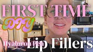 I filled my own lips AT HOME with a hyaluron pen, DIY before &amp; after | Liz