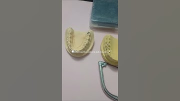 From cast knockdown ➝ RPD design 🦷 #dentistry #studentlife #prosthodontics #4thyear