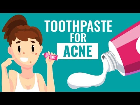 Is Using Toothpaste For Acne safe? || Know the Truth