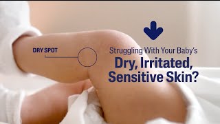 Help Soothe + Hydrate Baby’s Skin. With regular use, results may vary.