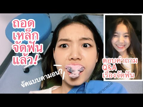 ถอดเหล็กแล้วนะ! ตอบคำถามจัดฟันแบบดามอน! |HollyHolland