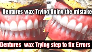 Dentures  Wax Trying  Mistakes  Errors  How to fix them