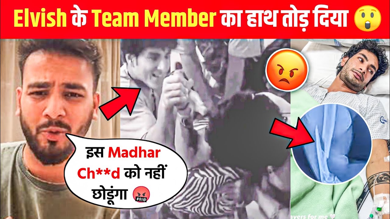 omg-elvish-yadav-team-member-hand-break-in-playground-season-4