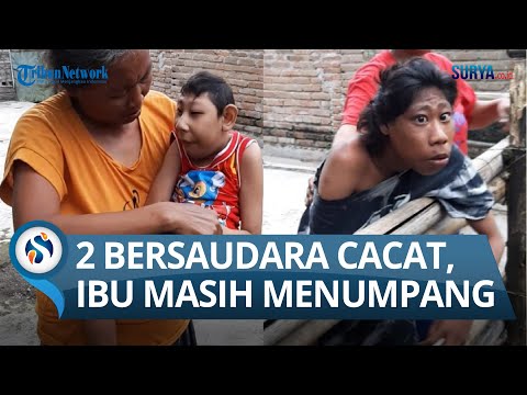 Video: Apakah itu kecacatan ssi?