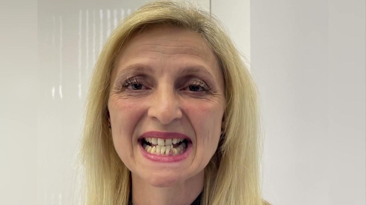 МОЕТО НОВО АЗ Епизод 4 Bellissimo Clinic - Историята на Татяна