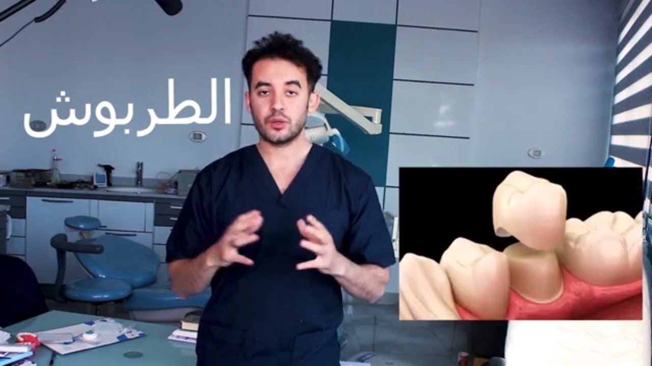 تركيبات الأسنان الثابة أو طربوش الأسنان