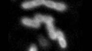 Fluorescence Imaging of Bacterial Binary Fission