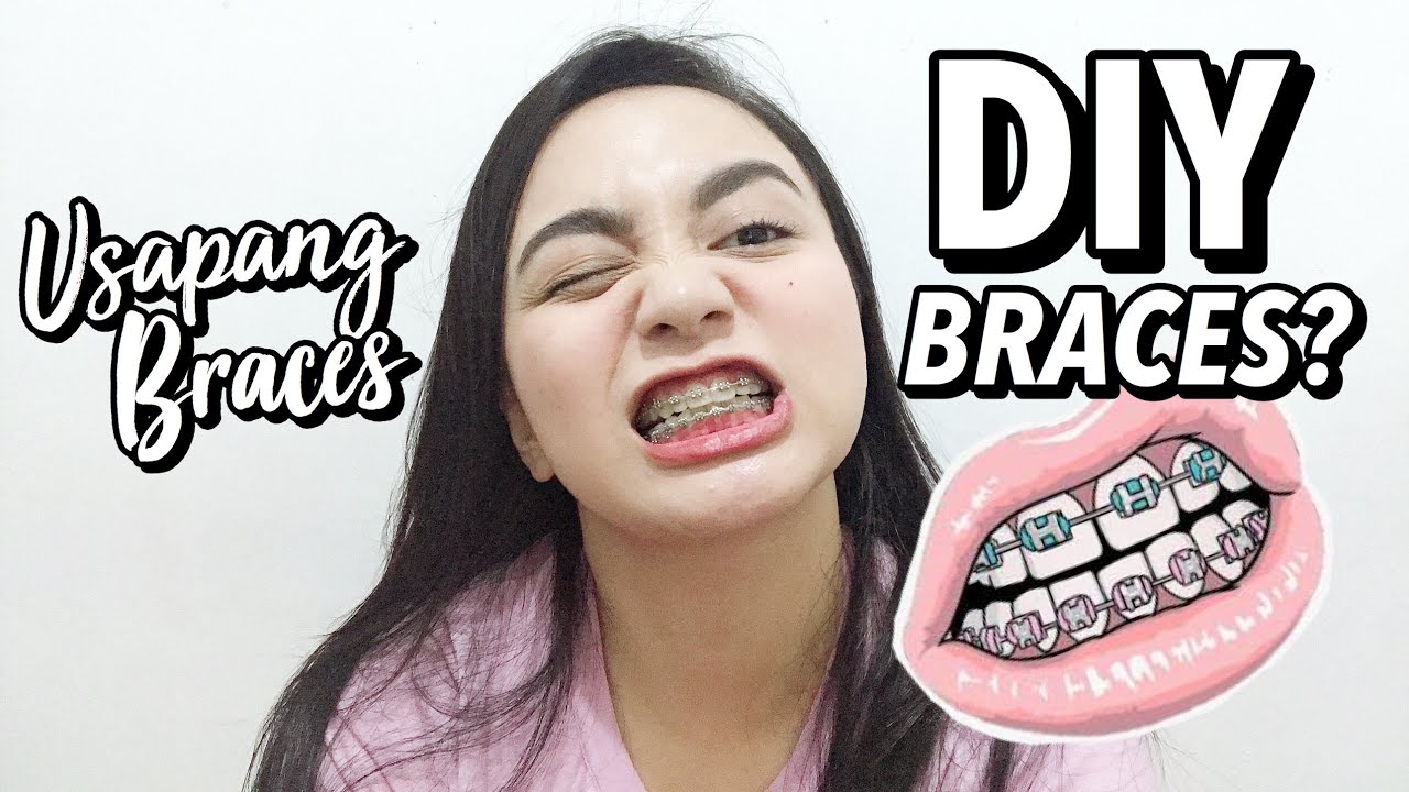 Usapang Braces (DIY BRACES?) Nikki Valiente YouTube