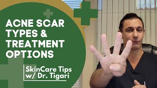 Doctor Goes Over The 4 Acne Scar Types & How To Treat Them