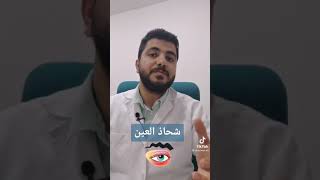 شحاذ العين