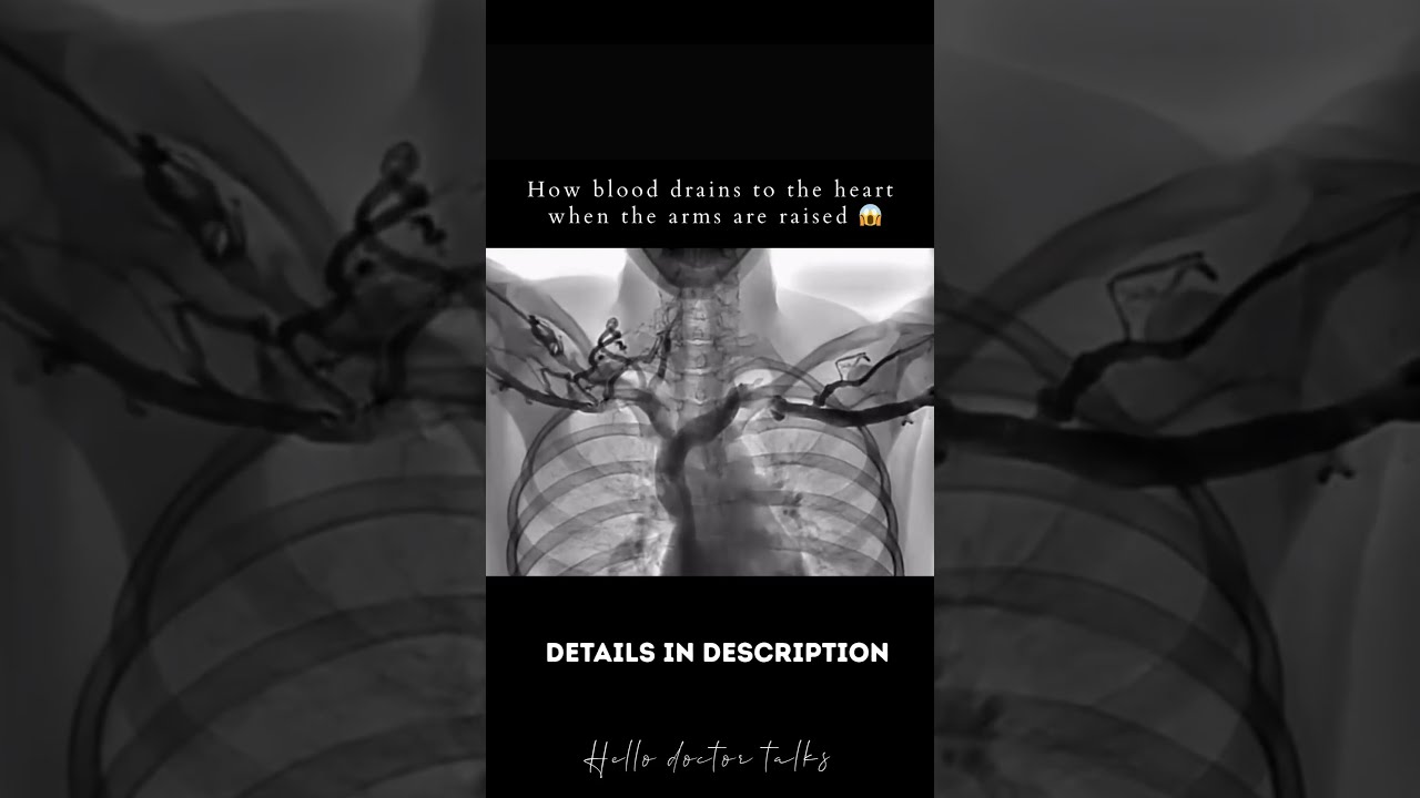 How Blood Drains To The Heart When Arms Are Raised Healthchannel Doctor Doctorslife