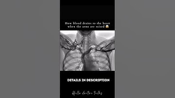 How blood drains to the heart when the arms are raised 😱 #healthchannel #doctor #heart #doctorslife