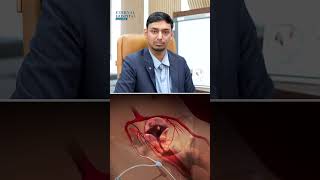 Fibroids se chutkara, bina kisi surgery ke! ✅