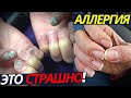 ЭТО СТРАШНО! Аллергия на ногтях | Маникюр и гель лак